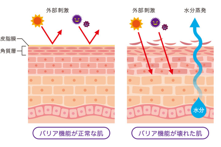 これからの乾燥肌対策：乾燥肌の原因とその対策の画像